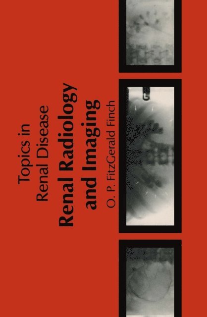 O.P. Fitzgerald-Finch - Renal Radiology and Imaging, E-bok