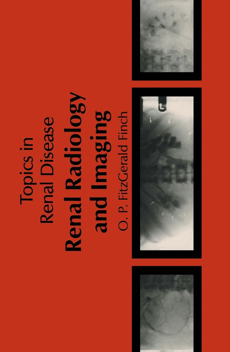 O.P. Fitzgerald-Finch - Renal Radiology and Imaging, Häftad