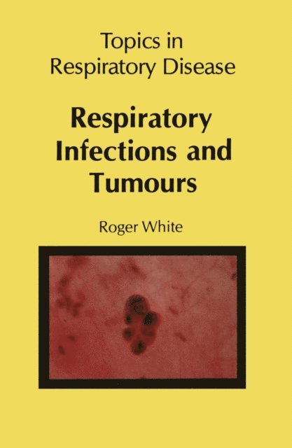 R. White - Respiratory Infections and Tumours, E-bok