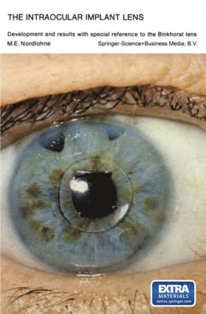 Marcel Eugene Nordlohne - Intraocular Implant Lens Development and Results with Special Reference to the Binkhorst Lens, E-bok