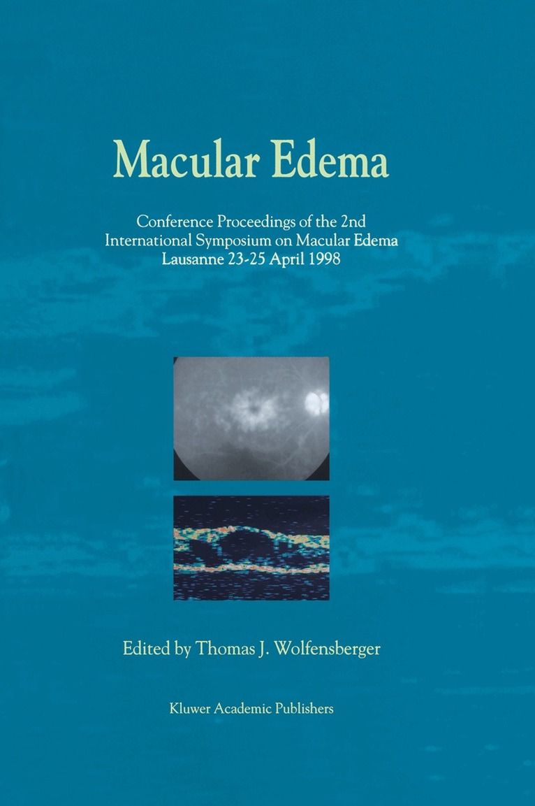 Thomas J. Wolfensberger, Thomas J. Wolfensberger - Macular Edema, Häftad. Tillgänglighet: Lägg i varukorg