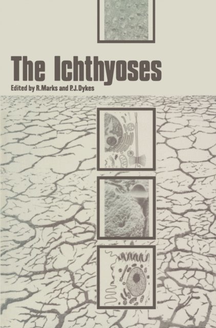 P.J. Dykes, R. Marks - Ichthyoses, E-bok