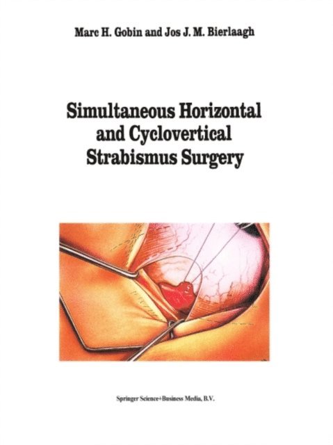 J.J.M Bierlaagh, M.H. Gobin - Simultaneous Horizontal and Cyclovertical Strabismus Surgery, E-bok