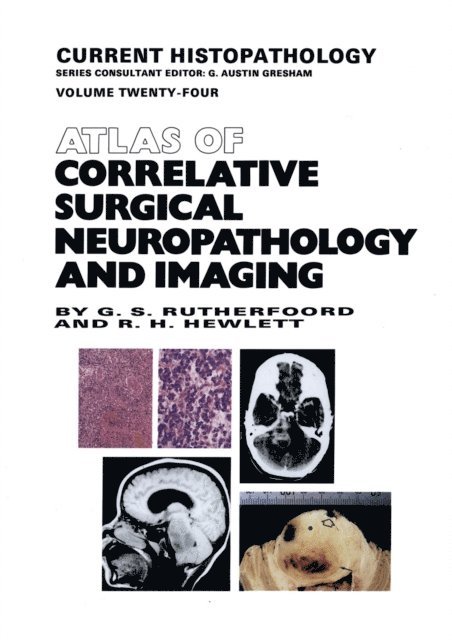 R.H. Hewlett, G.S. Rutherfoord - Atlas of Correlative Surgical Neuropathology and Imaging, E-bok