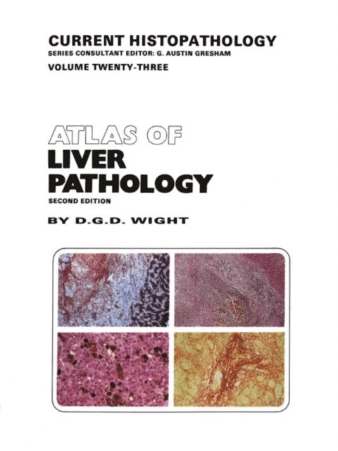 D.G. Wight - Atlas of Liver Pathology, E-bok