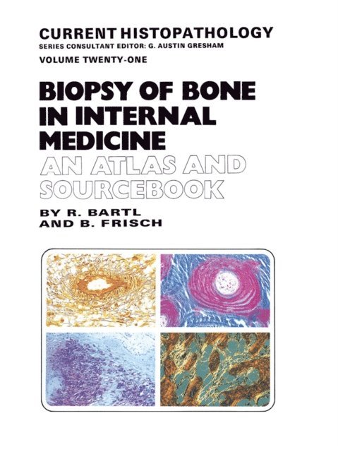 Bertha Frisch, Reiner Bartl - Biopsy of Bone in Internal Medicine: An Atlas and Sourcebook, E-bok
