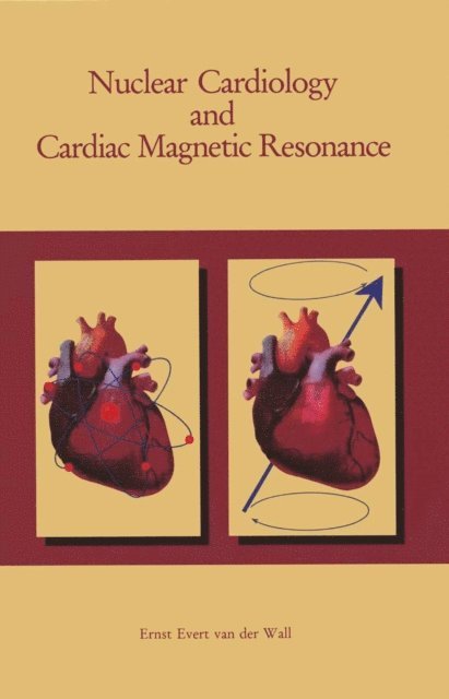 Ernst E. van der Wall - Nuclear Cardiology and Cardiac Magnetic Resonance, E-bok