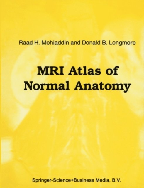 D.B. Longmore, Raad H. Mohiaddin - MRI Atlas of Normal Anatomy, E-bok