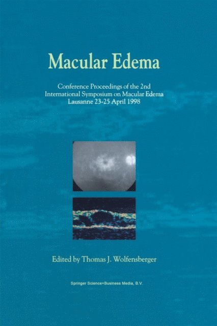 Thomas J. Wolfensberger - Macular Edema, E-bok. Tillgänglighet: Lägg i varukorg