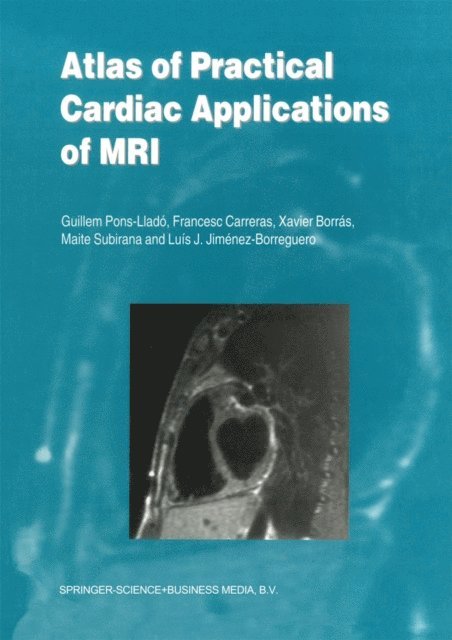 Luis J. Jimenez-Borreguero, Maite Subirana, Xavier Borras, Francesco Carreras, Guillem Pons-Llado - Atlas of Practical Cardiac Applications of MRI, E-bok