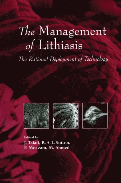 M. Ahmed, F. Moazam, R.A.L. Sutton, Jamsheer J. Talati - Management of Lithiasis, E-bok