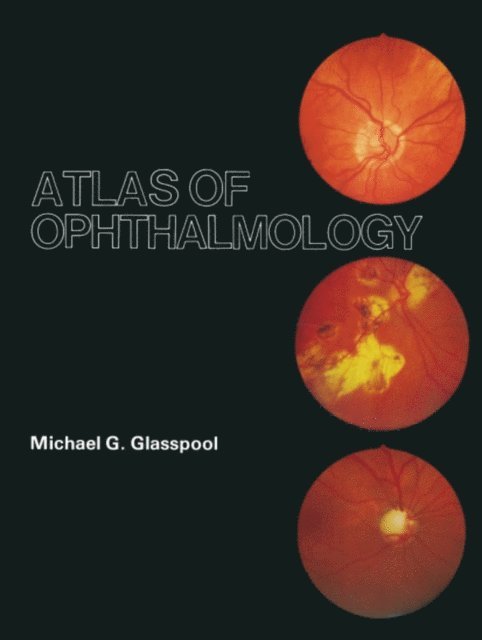 M.G. Glasspool - Atlas of Ophthalmology, E-bok