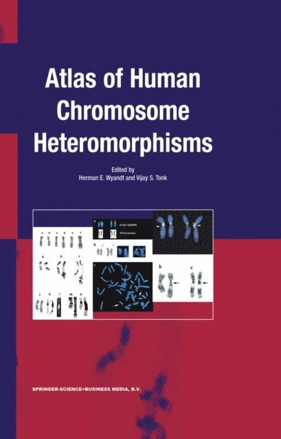 Vijay S. Tonk, H.E. Wyandt - Atlas of Human Chromosome Heteromorphisms, E-bok