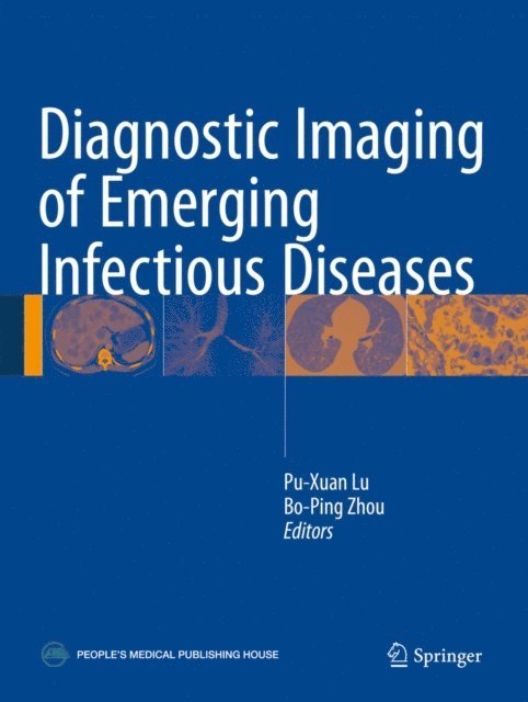 Bo-Ping Zhou, Pu-Xuan Lu - Diagnostic Imaging of Emerging Infectious Diseases, E-bok