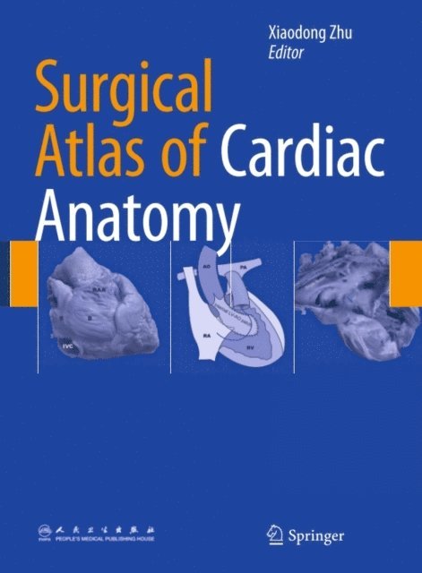 Xiaodong Zhu - Surgical Atlas of Cardiac Anatomy, E-bok