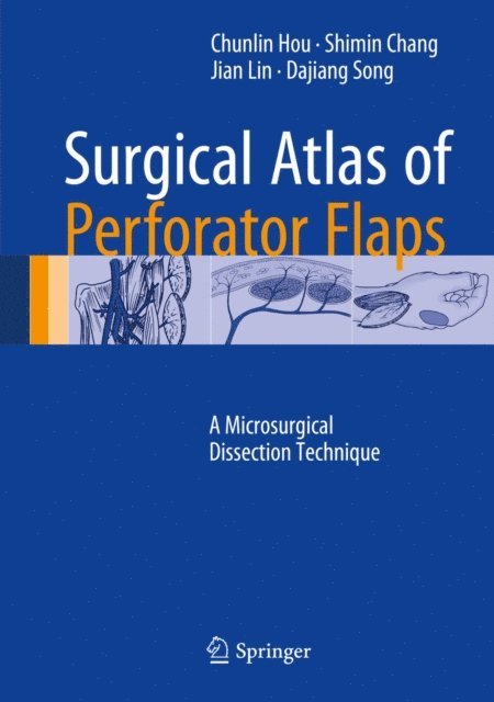 Dajiang Song, Jian Lin, Shimin Chang, Chunlin Hou - Surgical Atlas of Perforator Flaps, E-bok