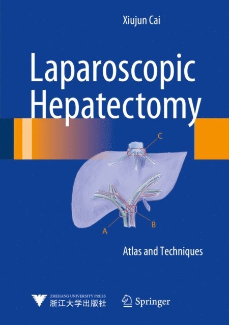 Xiujun Cai - Laparoscopic Hepatectomy, E-bok. Tillgänglighet: Lägg i varukorg