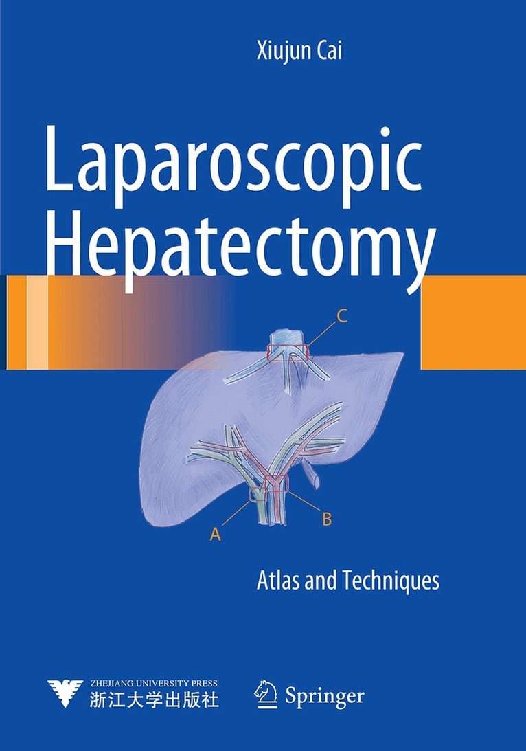 Xiujun Cai - Laparoscopic Hepatectomy, Häftad. Tillgänglighet: Lägg i varukorg