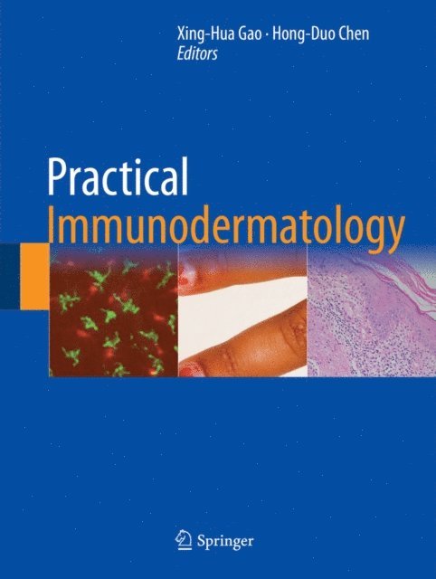 Hong-Duo Chen, Xing-Hua Gao - Practical Immunodermatology, E-bok