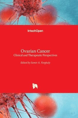 Samir A. Farghaly - Ovarian Cancer, Inbunden. Tillgänglighet: Lägg i varukorg