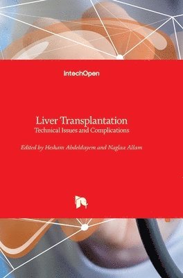 Hesham Abdeldayem, Naglaa Allam - Liver Transplantation, Inbunden. Tillgänglighet: Lägg i varukorg