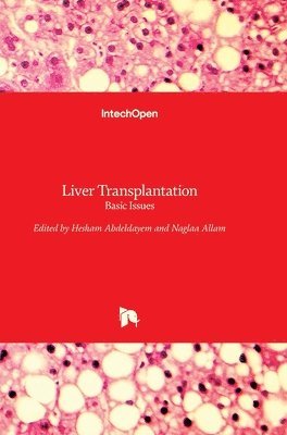 Hesham Abdeldayem, Naglaa Allam - Liver Transplantation, Inbunden. Tillgänglighet: Lägg i varukorg