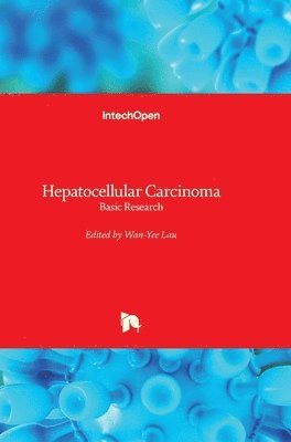 Wan-Yee Lau - Hepatocellular Carcinoma, Inbunden