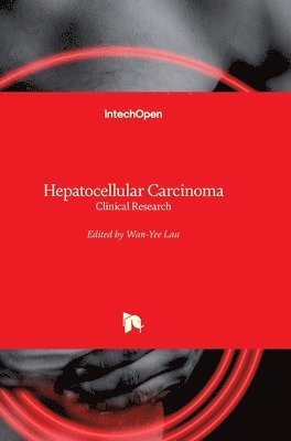 Wan-Yee Lau - Hepatocellular Carcinoma, Inbunden