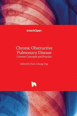 Kian-Chung Ong - Chronic Obstructive Pulmonary Disease, Inbunden. Tillgänglighet: Lägg i varukorg