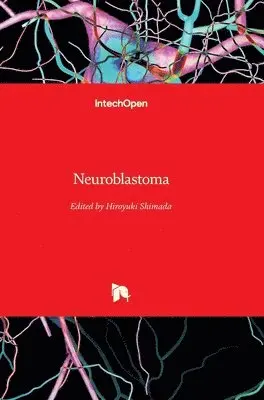 Hiroyuki Shimada - Neuroblastoma, Inbunden. Tillgänglighet: Lägg i varukorg