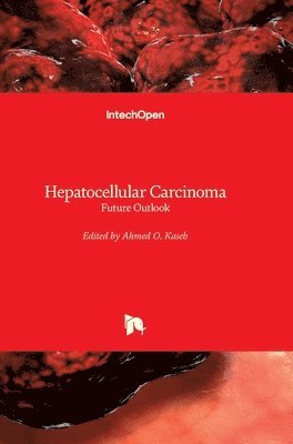 Ahmed O. Kaseb - Hepatocellular Carcinoma, Inbunden