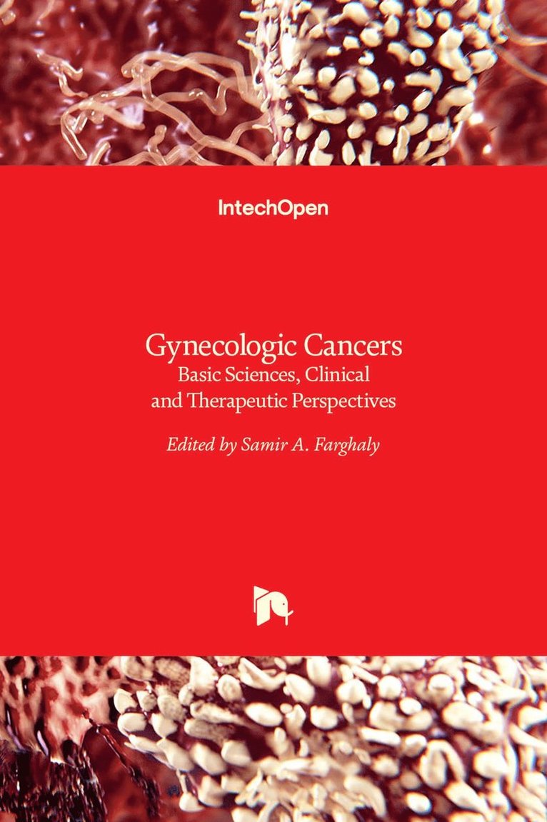 Samir A. Farghaly - Gynecologic Cancers, Inbunden. Tillgänglighet: Lägg i varukorg