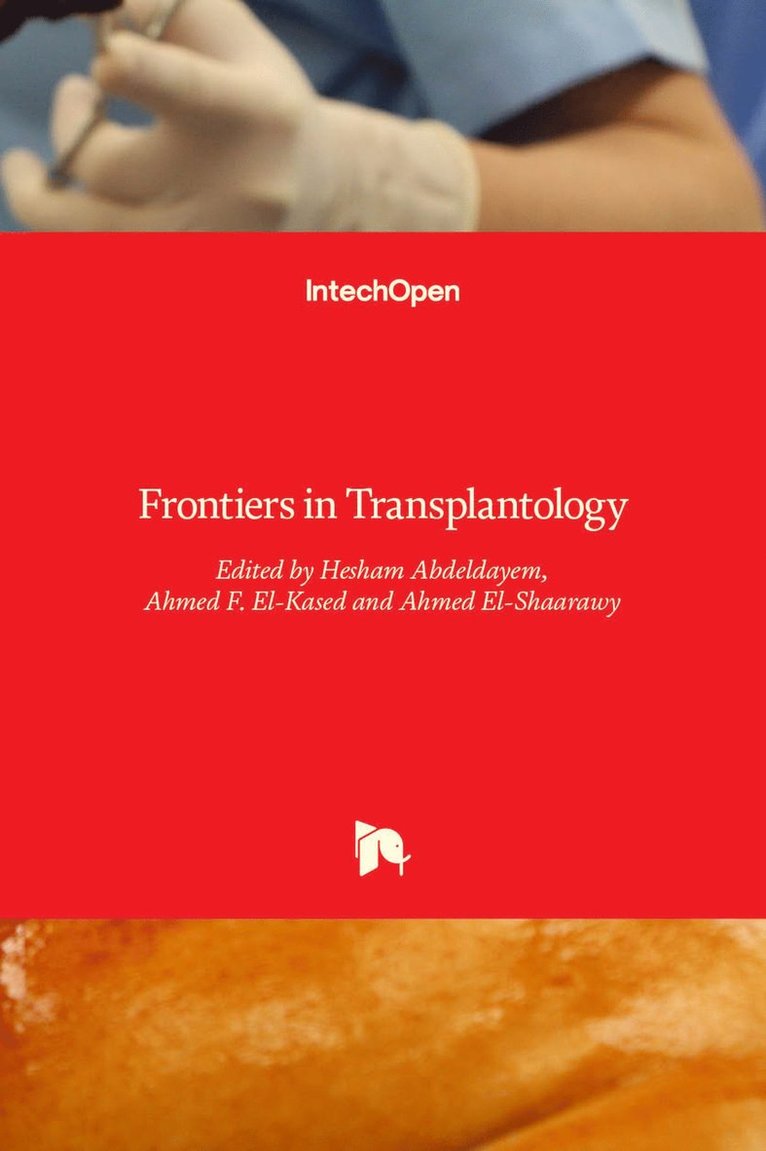Hesham Abdeldayem, Ahmed F. El-Kased, Ahmed El-Shaarawy - Frontiers in Transplantology, Inbunden. Tillgänglighet: Lägg i varukorg