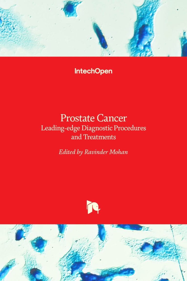 Ravinder Mohan - Prostate Cancer, Inbunden