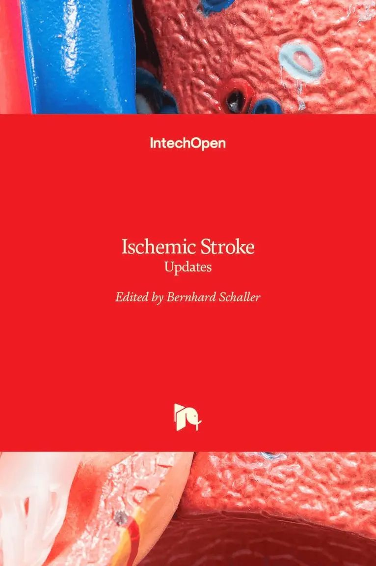 Bernhard Schaller - Ischemic Stroke, Inbunden. Tillgänglighet: Lägg i varukorg