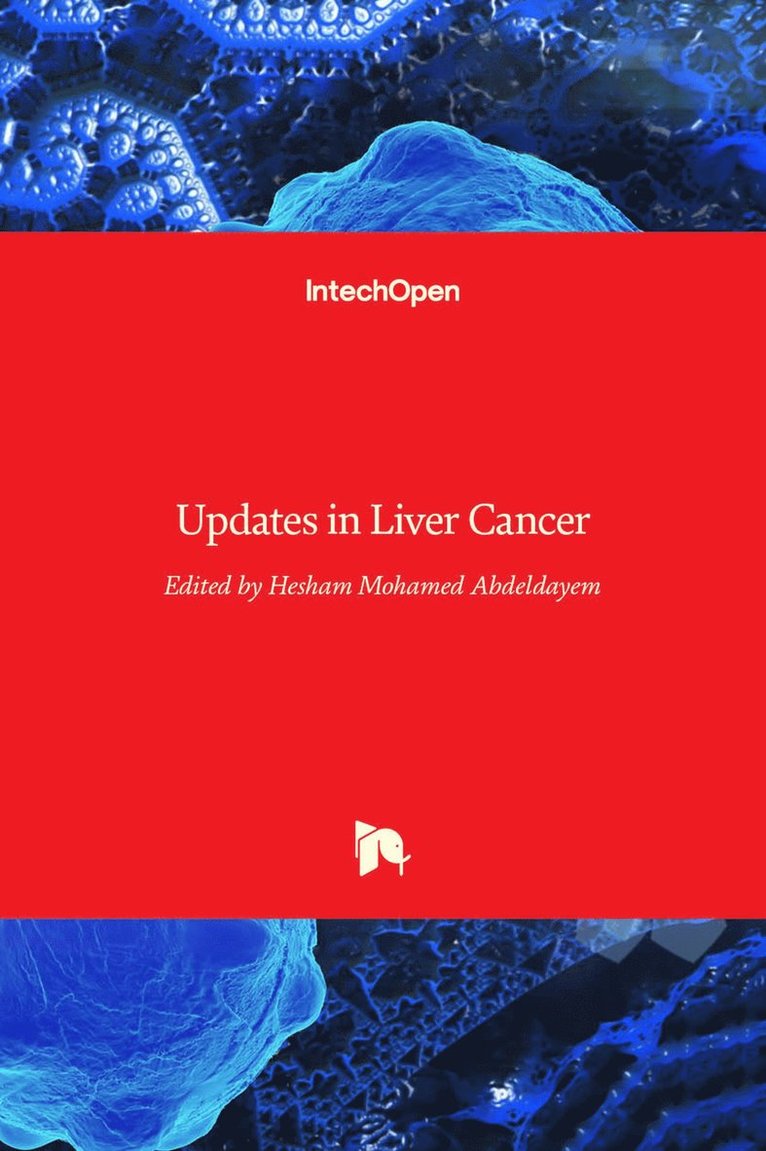 Hesham Mohamed Abdeldayem - Updates in Liver Cancer, Inbunden. Tillgänglighet: Lägg i varukorg