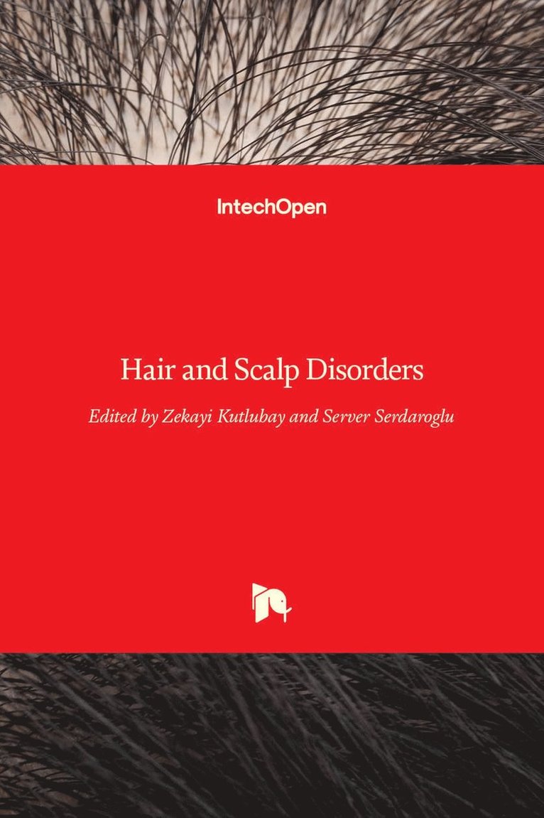 Zekayi Kutlubay, Server Serdaroglu - Hair and Scalp Disorders, Inbunden. Tillgänglighet: Lägg i varukorg
