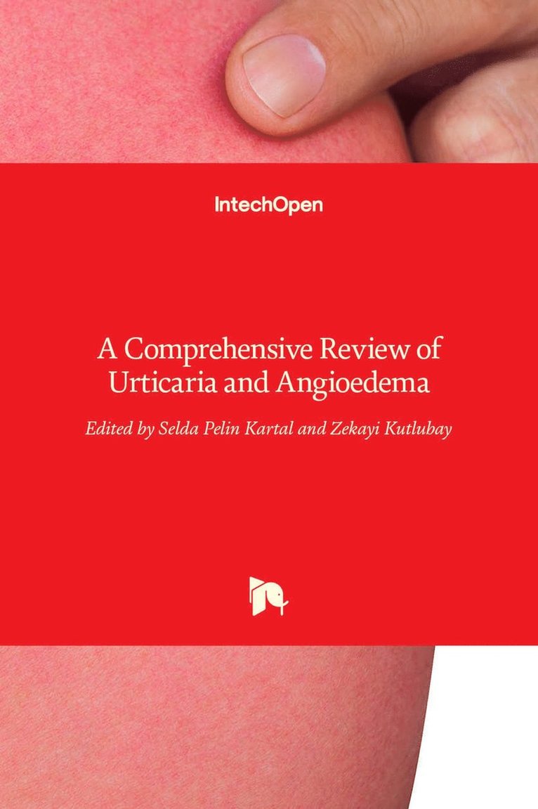 Selda Pelin Kartal, Zekayi Kutlubay - Urticaria and Angioedema, Inbunden. Tillgänglighet: Lägg i varukorg