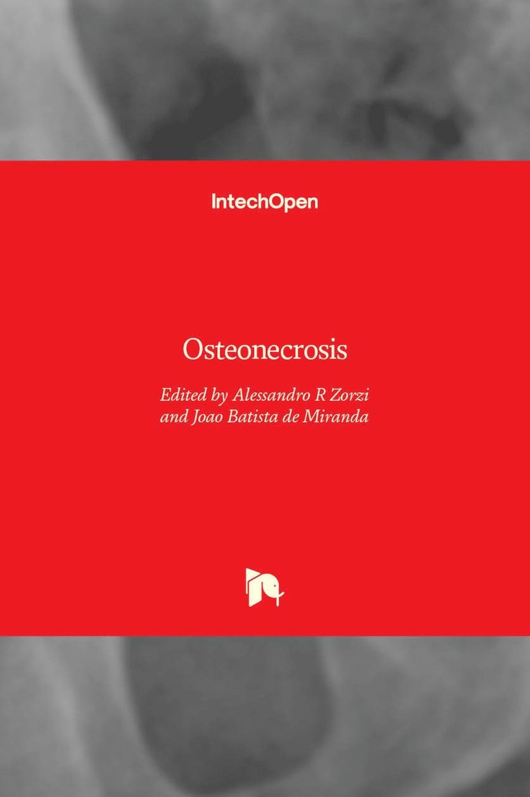 Alessandro R Zorzi, Joao Batista de Miranda - Osteonecrosis, Inbunden