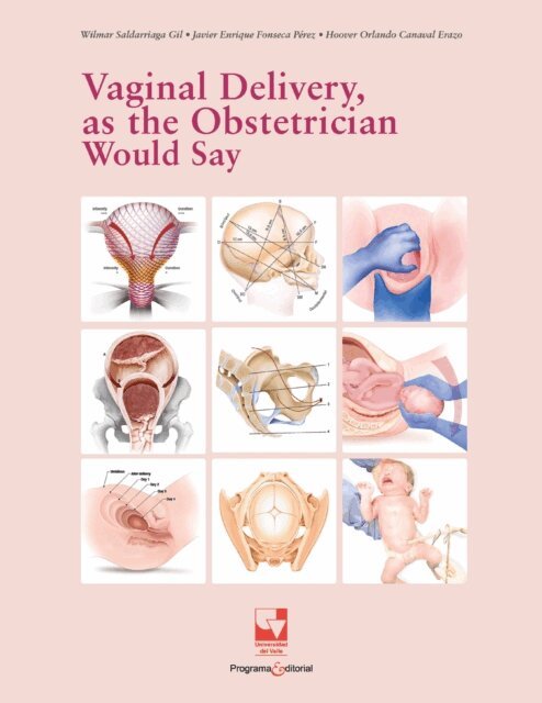 Javier Enrique Fonseca Perez, Hoover Orlando Canaval Erazo, Wilmar Saldarriaga Gil - Vaginal Delivery, as the Obstetrician Would Say, E-bok
