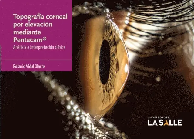 Topografía corneal por elevación mediante Pentacam®