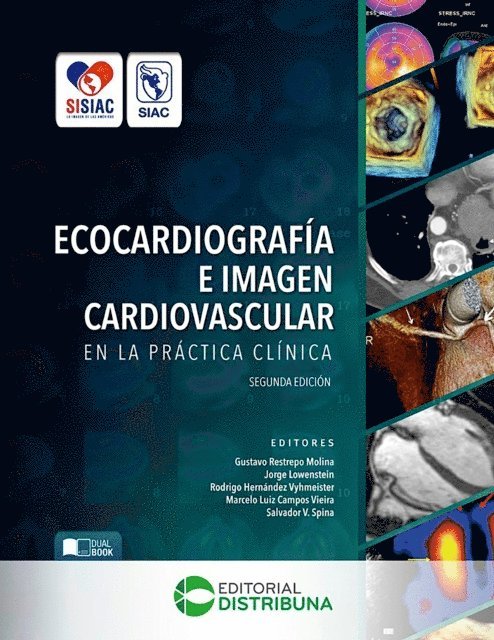 Salvador V Ospina, Marcelo Luiz Campos Vieira, Rodrigo Hernandez Vyhmeister, Jorge Lowenstein, Gustavo Restrepo Molina - Ecocardiografía e imagen cardiovascular en la práctica clínica. Segunda Edición, E-bok