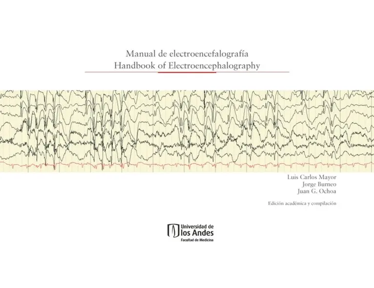 Juan Ochoa, Jorge Burneo, Luis Carlos Mayor - Manual de electroencefalografía. Handbook of electroencephalography (Edición Bilingüe), E-bok. Tillgänglighet: Lägg i varukorg