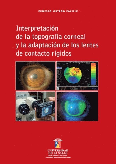 Ernesto Ortega Pacific - Interpretación de la topografía corneal y la adaptación de los lentes de contacto rígidos, E-bok. Tillgänglighet: Lägg i varukorg