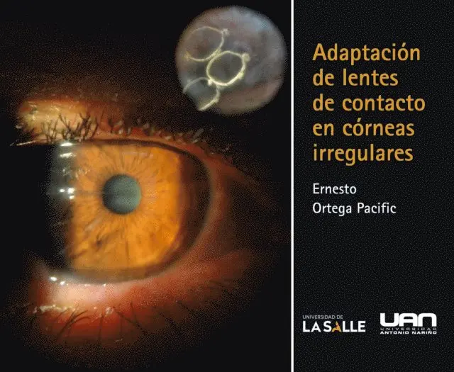 Ernesto Ortega Pacific - Adaptación de lentes de contacto en córneas irregulares, E-bok. Tillgänglighet: Lägg i varukorg