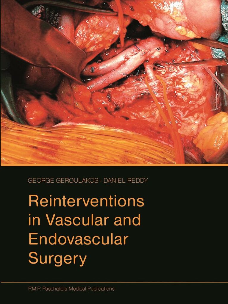 George Geroulakos, Daniel Reddy - Reinterventions in Vascular and Endovascular Surgery, Inbunden