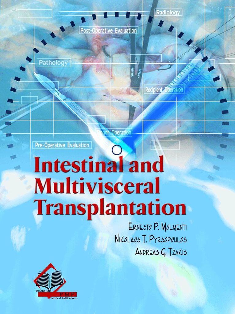 Ernesto P. Molmenti, Nikolaos T. Pyrsopoulos, Andreas G. Tzakis - Intestinal and Multivisceral Transplantation, Inbunden. Tillgänglighet: Tillfälligt slut
