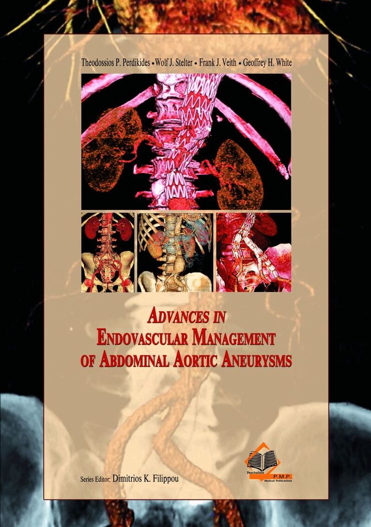 Theodossios P. Perkides, Wolf J. Stelter, Frank J. Veith, Geoffrey H. White - Advances in Endovascular Management of Abdominal Aortic Aneurysms, Inbunden. Tillgänglighet: Tillfälligt slut