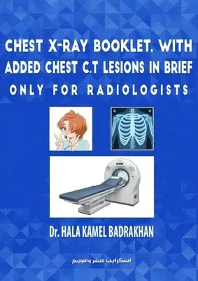 Hala Kamel Badrakhan - Chest X-Ray Booklet, with added Chest C.T Lesions in brief Only for Radiologists, Häftad. Tillgänglighet: Lägg i varukorg