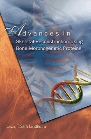 LINDHOLM T SAM, T Sam Lindholm - ADVANCES IN SKELETAL RECONSTRUCTION USING BONE MORPHOGENETIC PROTEINS, Inbunden
